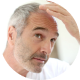 Hair Loss